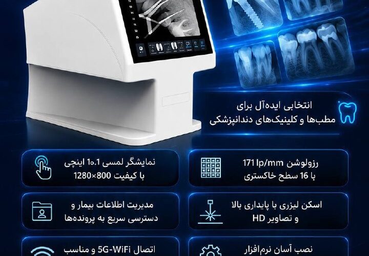 تصویر آگهی فسفر پلیت